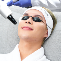 Laser Rejuvenation