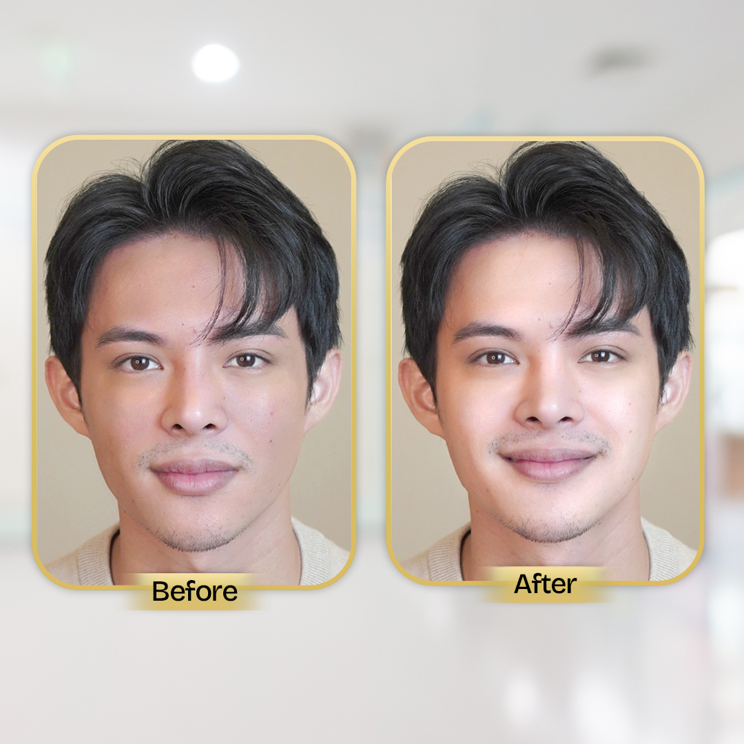 Before and After Treatment