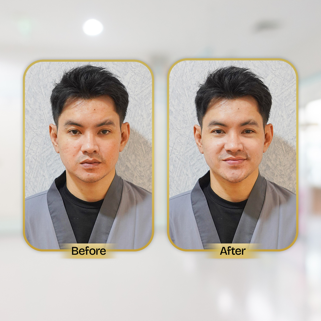 Before and After Treatment