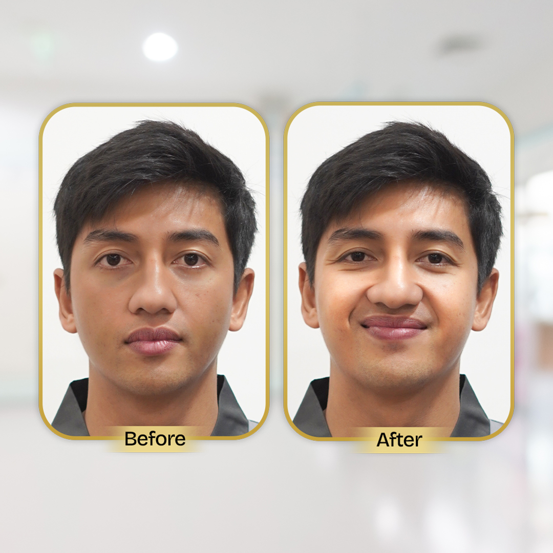 Before and After Treatment