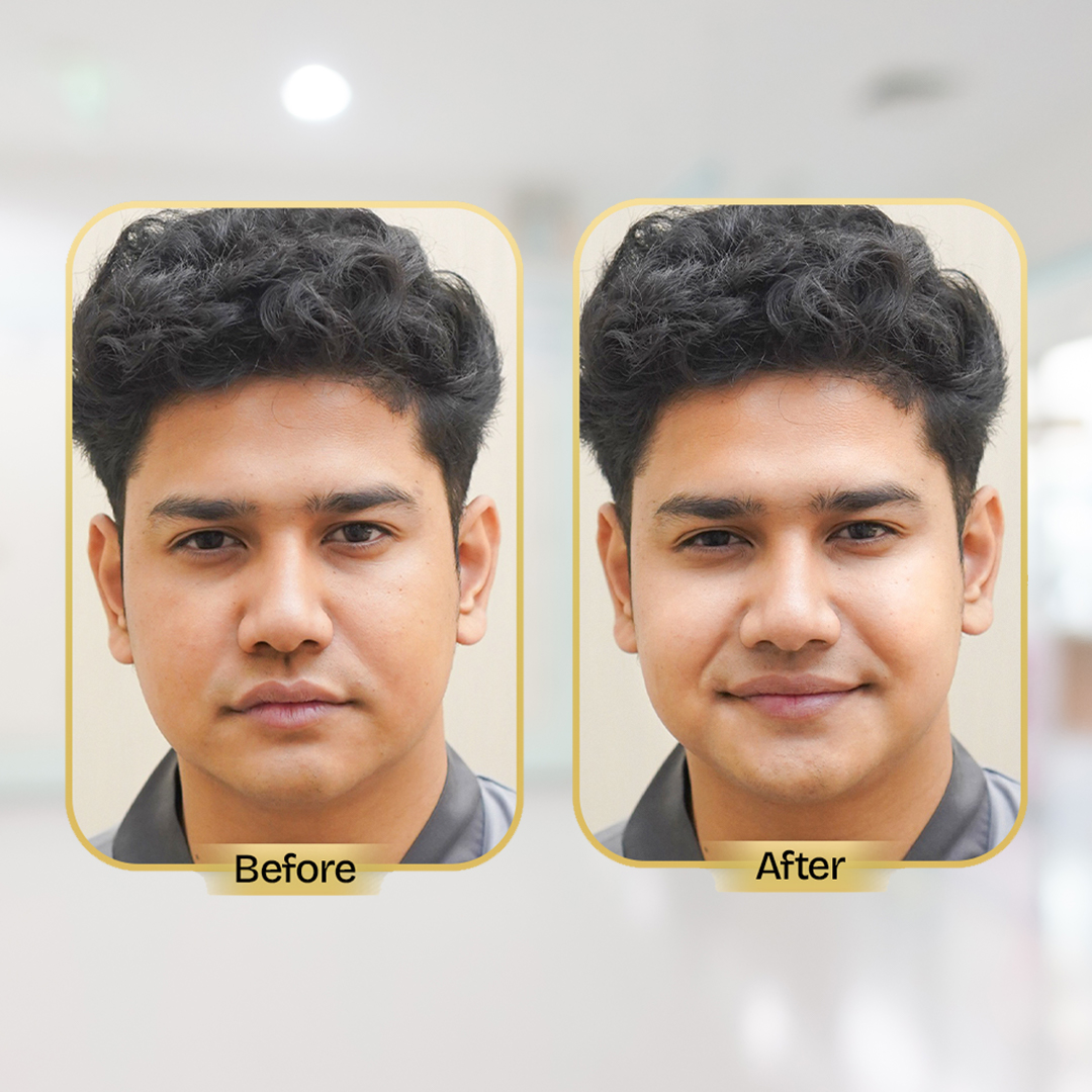 Before and After Treatment