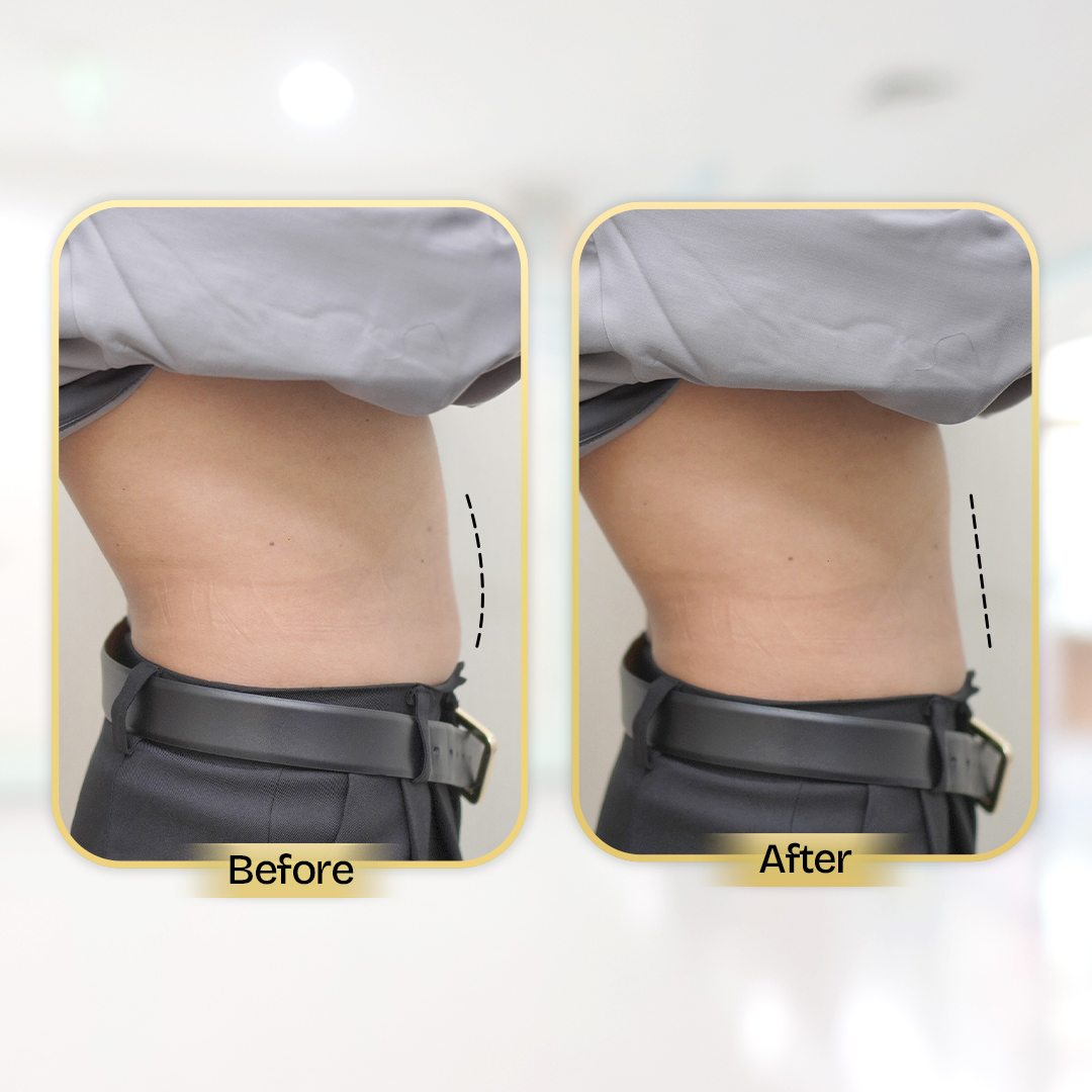 Before and After Treatment